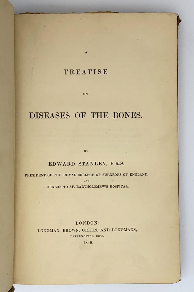 Item #402059 A Treatise on Diseases of the Bones. Edward STANLEY.